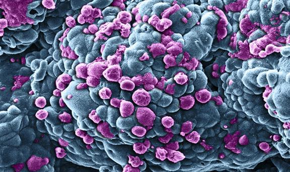 Lotta ai tumori: scoperta proteina alla base della proliferazione