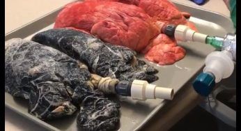 Il confronto tra i polmoni di un fumatore e di un non fumatore in un video shock