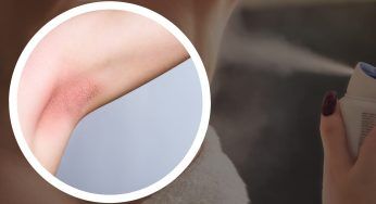 “Buttali nella spazzatura” Deodoranti, queste famosissime marche sono colme di alluminio