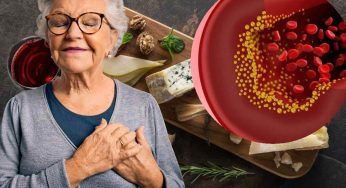 Questo formaggio protegge chi soffre di colesterolo alto: assurdo, erano tutti convinti del contrario