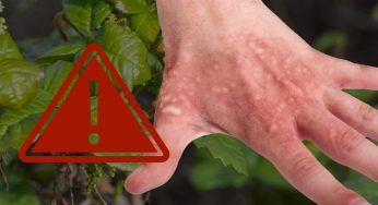 Occhio a questa pianta che in tanti coltivano: è tossica | Ti ustioni all’istante