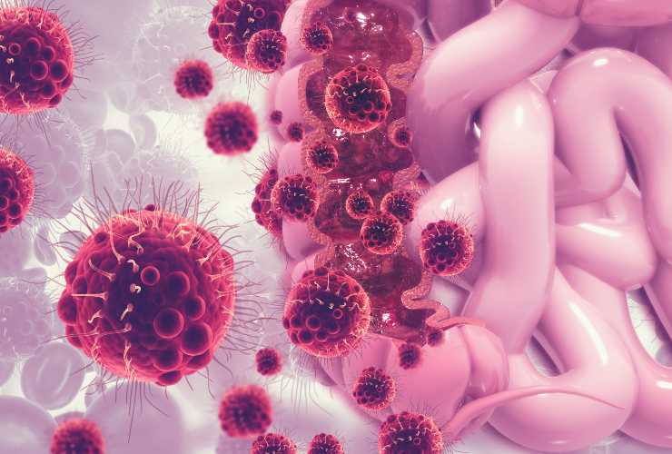 Cellule cancerogene nel colon