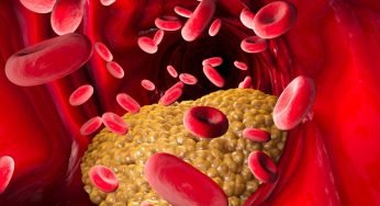 Approvato primo farmaco che riduce il colesterolo LDL | Due iniezioni all’anno