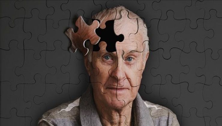 Test d'intelligenza per combattere l'Alzheimer
