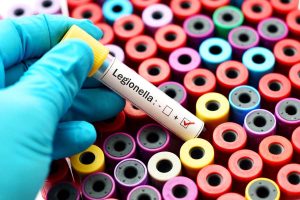 legionella