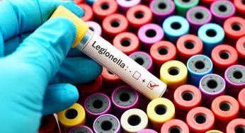 Anziana morta di legionella, scatta la disinfezione nella Rsa